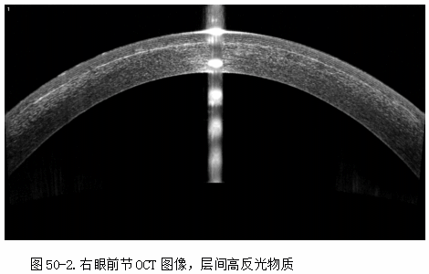 ZY016_268_3.gif